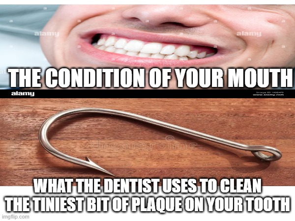 Dentists be like | THE CONDITION OF YOUR MOUTH; WHAT THE DENTIST USES TO CLEAN THE TINIEST BIT OF PLAQUE ON YOUR TOOTH | image tagged in dentists | made w/ Imgflip meme maker