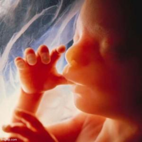 Fetus | image tagged in fetus | made w/ Imgflip meme maker