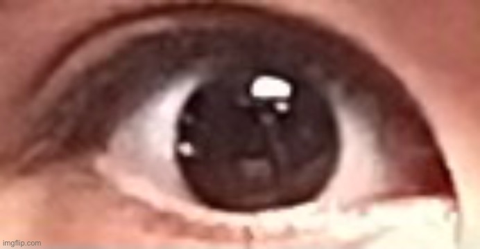 My eyeball | made w/ Imgflip meme maker