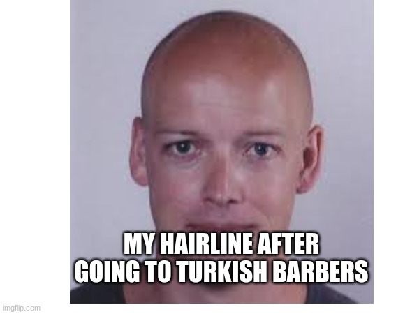 Turkish barbers | MY HAIRLINE AFTER GOING TO TURKISH BARBERS | image tagged in fun,funny,hairless,barber | made w/ Imgflip meme maker