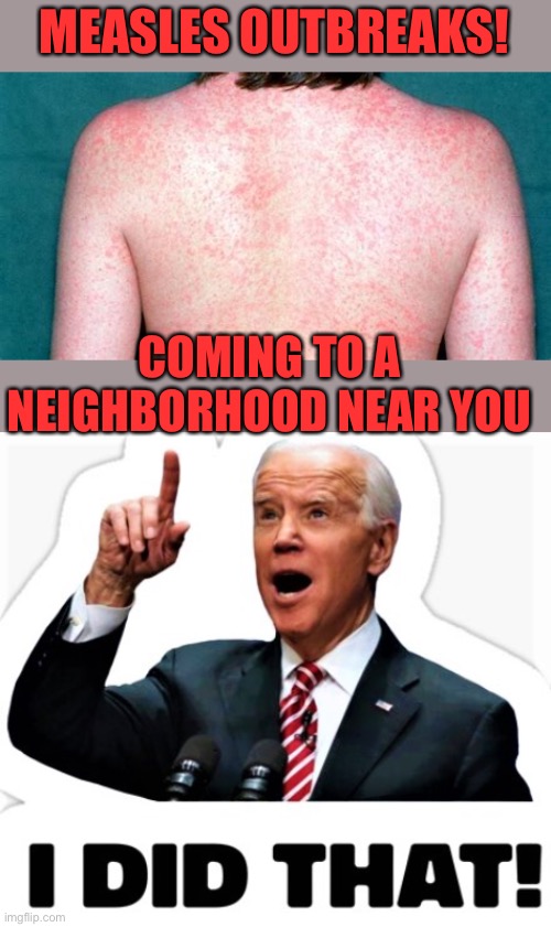 Biden’s open borders brings in disease along with drugs, invaders and terrorists. Your safety and welfare is at risk, | MEASLES OUTBREAKS! COMING TO A NEIGHBORHOOD NEAR YOU | image tagged in biden - i did that,measles,open borders | made w/ Imgflip meme maker
