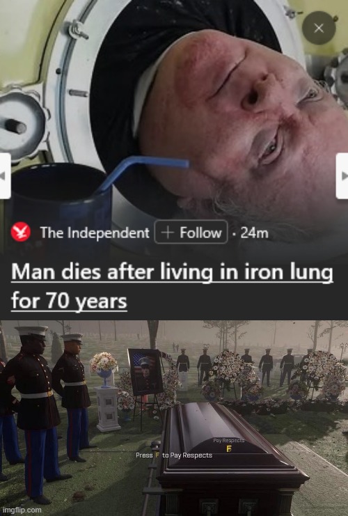 I heard about this guy as a kid, he had polio and had to live inside a machine for the rest of his life (NOT DEAD IN PIC) | image tagged in press f to pay respects | made w/ Imgflip meme maker
