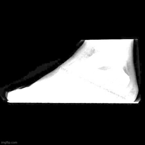 My xray looks funny | made w/ Imgflip meme maker