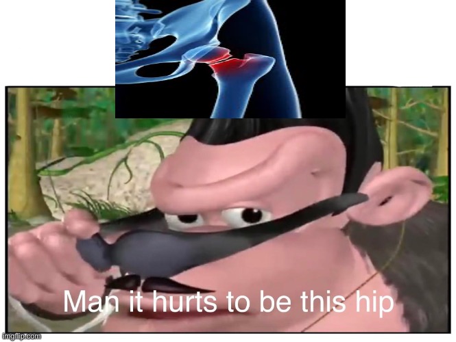 Hahahaha Don’t Kill Me | image tagged in man it hurts to be this hip,injury | made w/ Imgflip meme maker