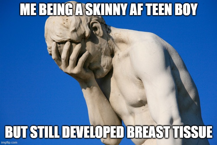 gotta love gyno | ME BEING A SKINNY AF TEEN BOY; BUT STILL DEVELOPED BREAST TISSUE | image tagged in embarrassed statue,teen,puberty,i wrap myself in bandages,funny memes,humor | made w/ Imgflip meme maker