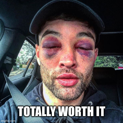Double black eye | TOTALLY WORTH IT | image tagged in double black eye | made w/ Imgflip meme maker