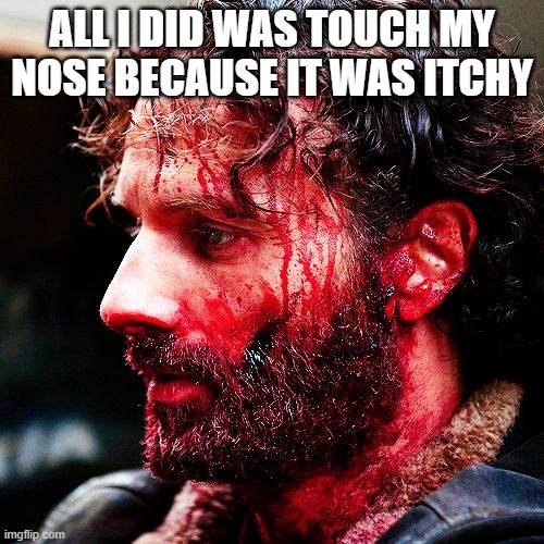 Bloody Rick Walking Dead | ALL I DID WAS TOUCH MY NOSE BECAUSE IT WAS ITCHY | image tagged in bloody rick walking dead | made w/ Imgflip meme maker