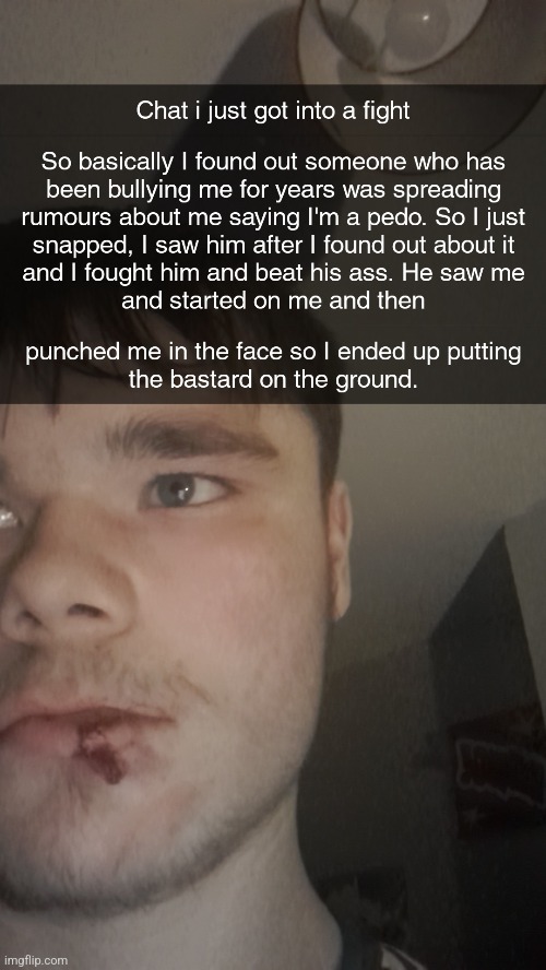 My face hurts now-Emosnake | made w/ Imgflip meme maker