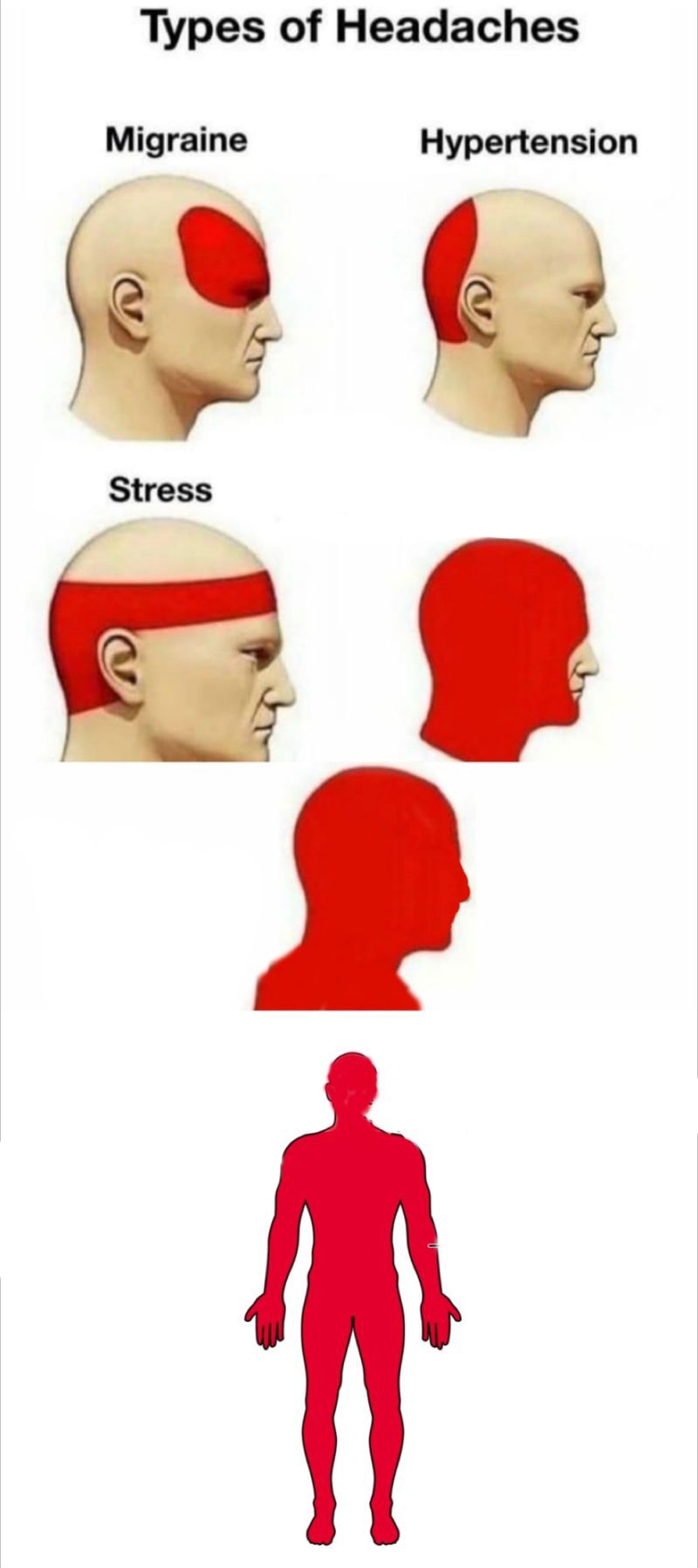 High Quality types of headaches Blank Meme Template