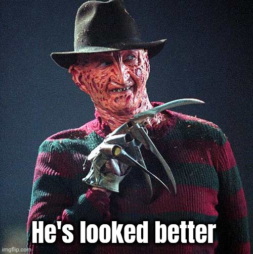 Freddy Krueger | He's looked better | image tagged in freddy krueger | made w/ Imgflip meme maker