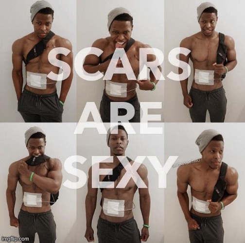 Scars are sexy | image tagged in scar,sexy | made w/ Imgflip meme maker