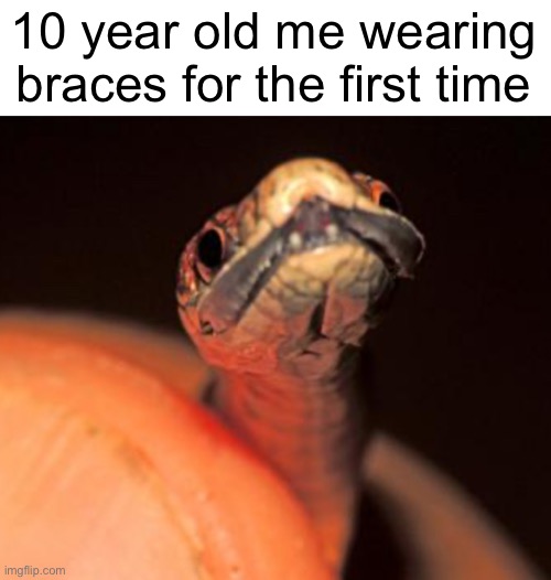10 year old me wearing braces for the first time | image tagged in snek,braces,smile,cute | made w/ Imgflip meme maker