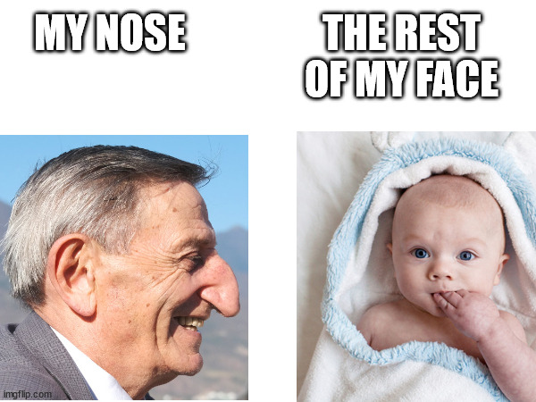 True story | THE REST OF MY FACE; MY NOSE | image tagged in nose | made w/ Imgflip meme maker