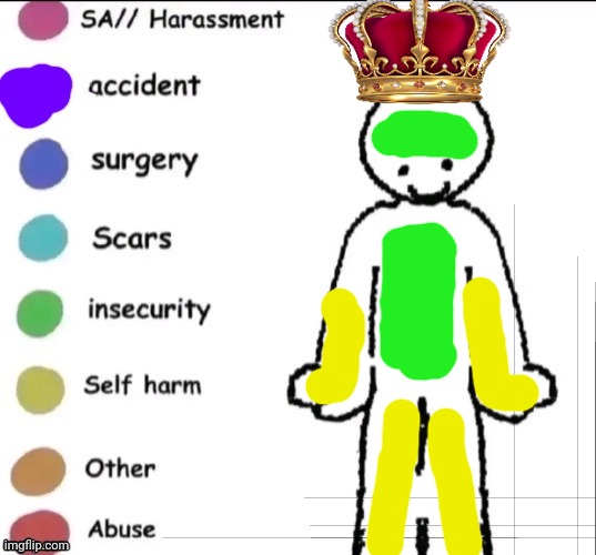 Royals be like | image tagged in pain chart | made w/ Imgflip meme maker