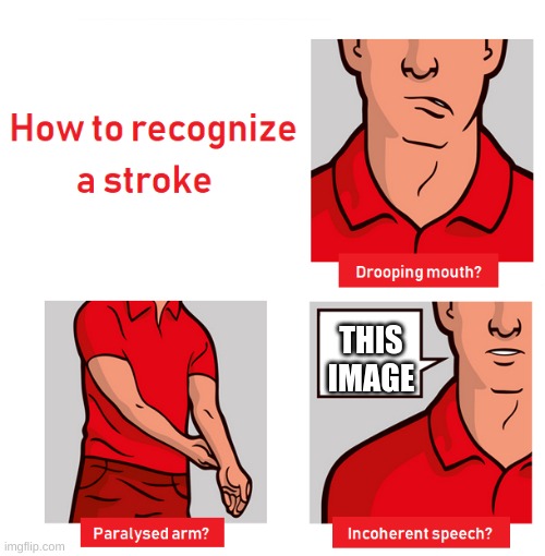signs of a stroke | THIS IMAGE | image tagged in signs of a stroke | made w/ Imgflip meme maker