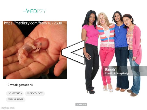 Fetuses are less than grown women | < | image tagged in abortion | made w/ Imgflip meme maker