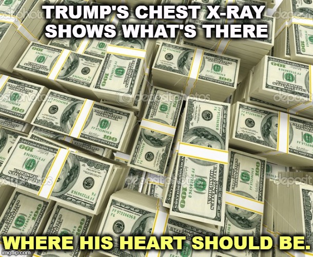 TRUMP'S CHEST X-RAY 
SHOWS WHAT'S THERE; WHERE HIS HEART SHOULD BE. | image tagged in trump,heartless,greedy,disgusting | made w/ Imgflip meme maker