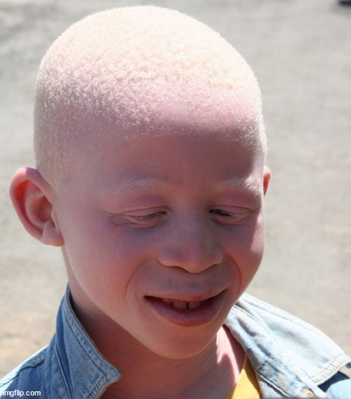 Albino | image tagged in albino | made w/ Imgflip meme maker