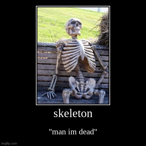 skeleton | "man im dead" | image tagged in funny,demotivationals | made w/ Imgflip demotivational maker