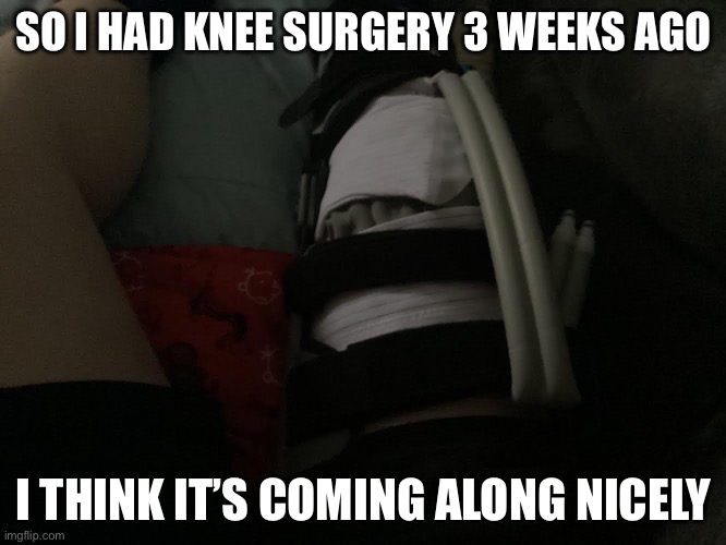 SO I HAD KNEE SURGERY 3 WEEKS AGO; I THINK IT’S COMING ALONG NICELY | made w/ Imgflip meme maker