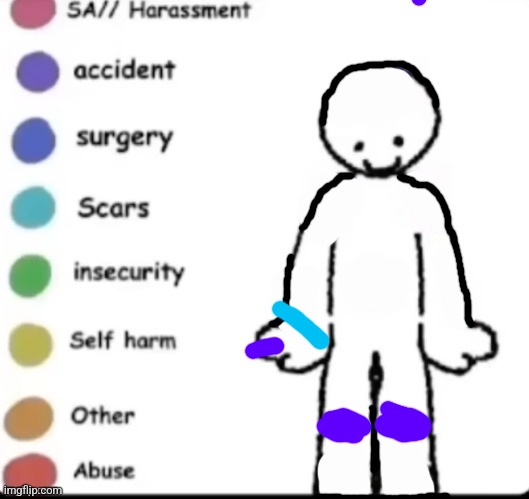 The scars are from my cat and oven accidents | image tagged in make your own | made w/ Imgflip meme maker