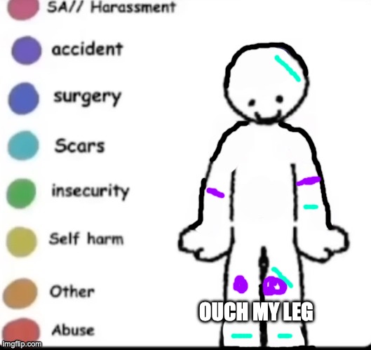 pink :skull: | OUCH MY LEG | image tagged in so i tried,this template,so you guys,can laugh,at me,funny | made w/ Imgflip meme maker