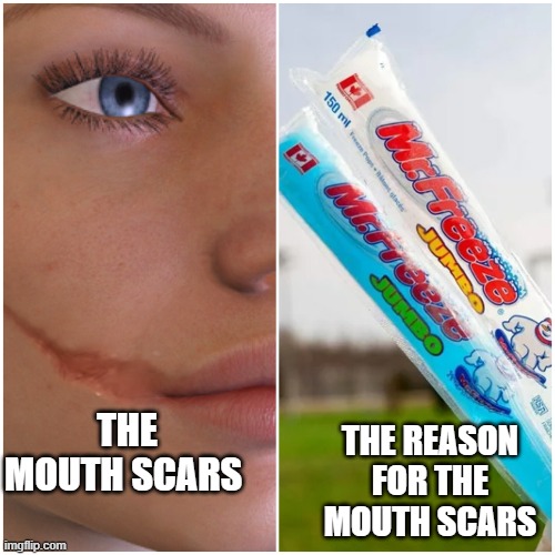the plastic on these were knives | THE REASON FOR THE MOUTH SCARS; THE MOUTH SCARS | image tagged in why must you hurt me in this way | made w/ Imgflip meme maker
