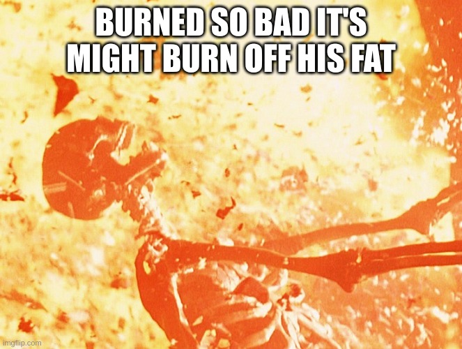 Fire skeleton | BURNED SO BAD IT'S MIGHT BURN OFF HIS FAT | image tagged in fire skeleton | made w/ Imgflip meme maker