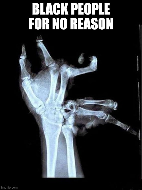 Broken Hand | BLACK PEOPLE FOR NO REASON | image tagged in broken hand | made w/ Imgflip meme maker