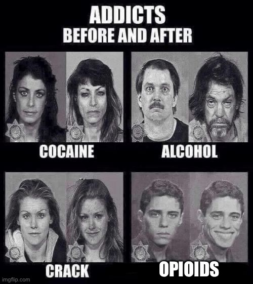 Addicts before and after | OPIOIDS | image tagged in addicts before and after | made w/ Imgflip meme maker