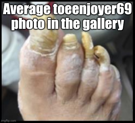 po-tae-toes | Average toeenjoyer69 photo in the gallery | image tagged in ugly toe nails | made w/ Imgflip meme maker
