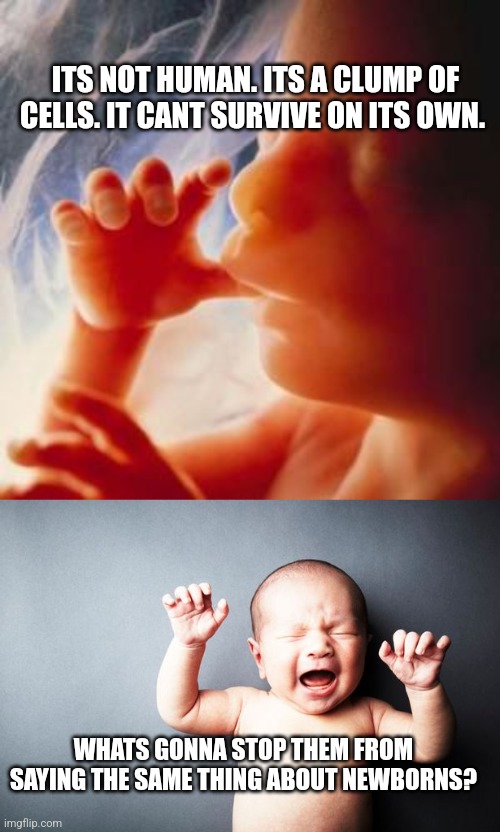 ITS NOT HUMAN. ITS A CLUMP OF CELLS. IT CANT SURVIVE ON ITS OWN. WHATS GONNA STOP THEM FROM SAYING THE SAME THING ABOUT NEWBORNS? | image tagged in fetus,newborn baby | made w/ Imgflip meme maker