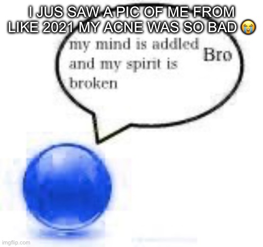 my mind bro ball | I JUS SAW A PIC OF ME FROM LIKE 2021 MY ACNE WAS SO BAD 😭 | image tagged in my mind bro ball | made w/ Imgflip meme maker