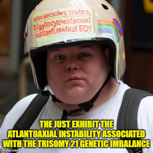 rere | THE JUST EXHIBIT THE ATLANTOAXIAL INSTABILITY ASSOCIATED WITH THE TRISOMY 21 GENETIC IMBALANCE | image tagged in rere | made w/ Imgflip meme maker