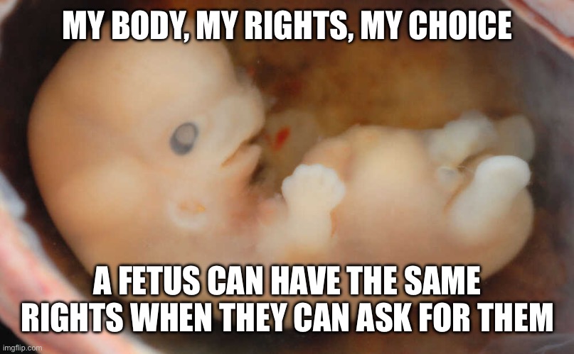 Unequal abortion | MY BODY, MY RIGHTS, MY CHOICE; A FETUS CAN HAVE THE SAME RIGHTS WHEN THEY CAN ASK FOR THEM | image tagged in abortion,human rights,feminism | made w/ Imgflip meme maker