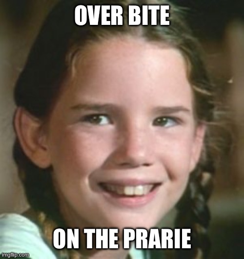 Over Bite on the Prarie | OVER BITE; ON THE PRARIE | image tagged in teeth | made w/ Imgflip meme maker