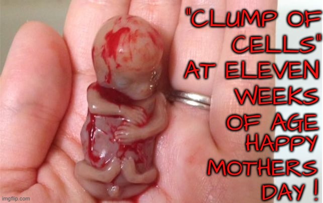 Happy Mothers Day | "CLUMP OF
CELLS"; AT ELEVEN
WEEKS
OF AGE; HAPPY
MOTHERS
DAY ! | image tagged in mothers day,mom,pro choice,abortion,abortion is murder,murder | made w/ Imgflip meme maker