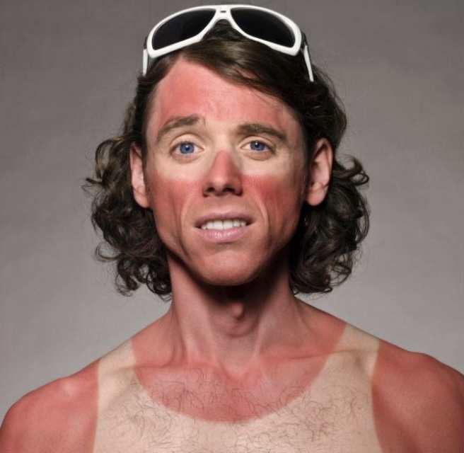 High Quality Sun burn guy Blank Meme Template