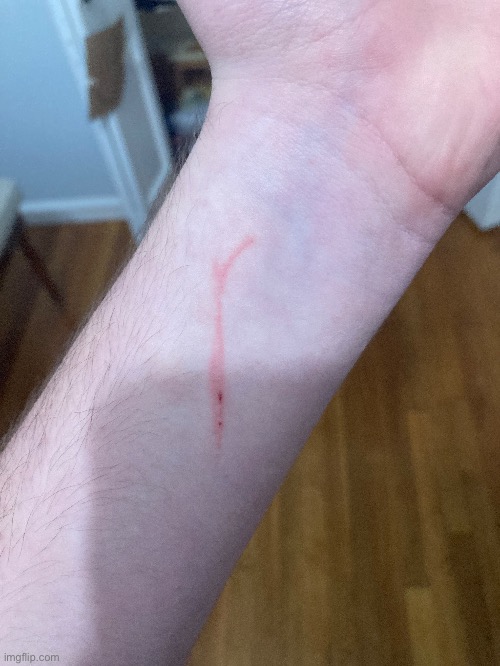 My dog scratched me (I’m ok btw) | made w/ Imgflip meme maker