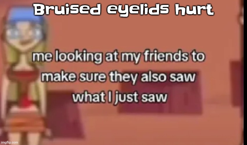 Agh | Bruised eyelids hurt | image tagged in scare | made w/ Imgflip meme maker