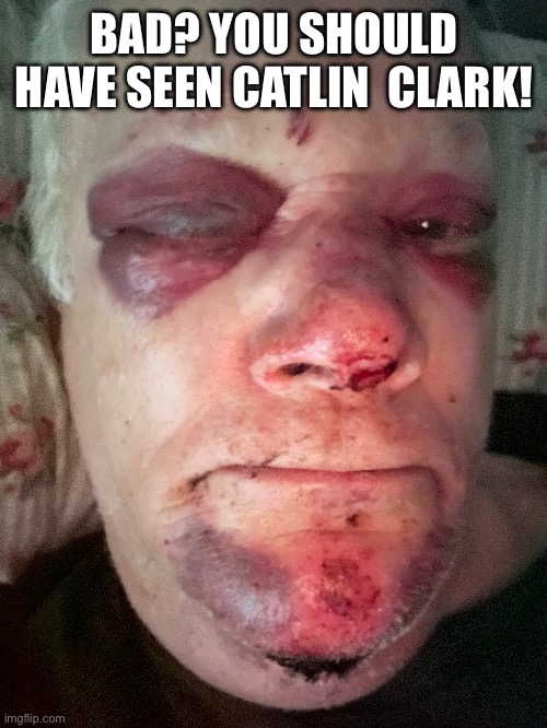 Should have seen……. | BAD? YOU SHOULD HAVE SEEN CATLIN  CLARK! | image tagged in funny but true | made w/ Imgflip meme maker