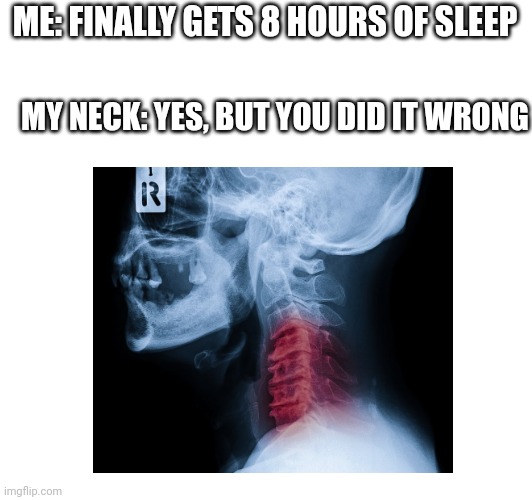 You did it wrong... | ME: FINALLY GETS 8 HOURS OF SLEEP; MY NECK: YES, BUT YOU DID IT WRONG | image tagged in neck pain | made w/ Imgflip meme maker