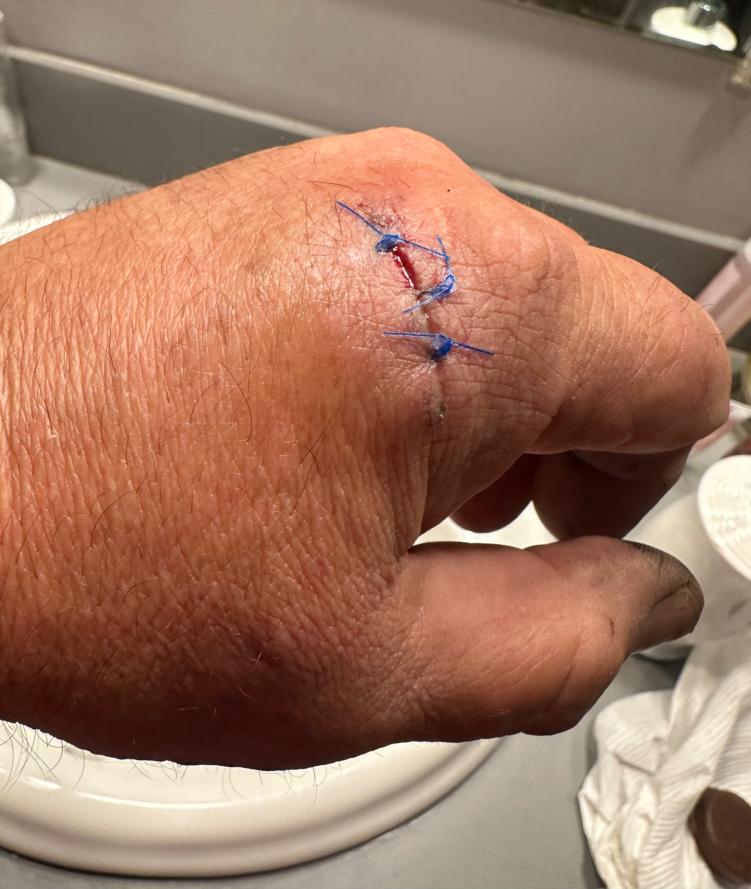Cut hand again Blank Meme Template