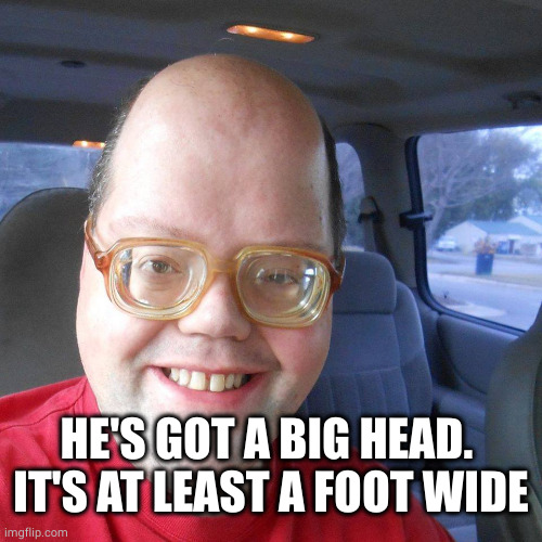 Big headed geek | HE'S GOT A BIG HEAD. 
IT'S AT LEAST A FOOT WIDE | image tagged in big headed geek | made w/ Imgflip meme maker