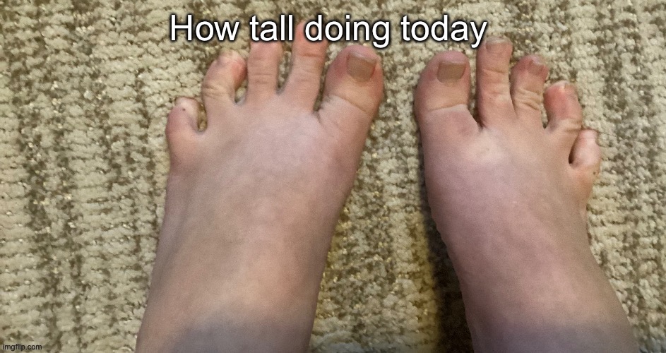 IcyXD FEET!!! v2 | How tall doing today | image tagged in icyxd feet v2 | made w/ Imgflip meme maker