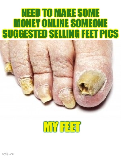 My Feet | NEED TO MAKE SOME MONEY ONLINE SOMEONE SUGGESTED SELLING FEET PICS; MY FEET | image tagged in feet,money,foot pics | made w/ Imgflip meme maker