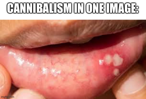 I hate it when this happens | CANNIBALISM IN ONE IMAGE: | image tagged in pain | made w/ Imgflip meme maker