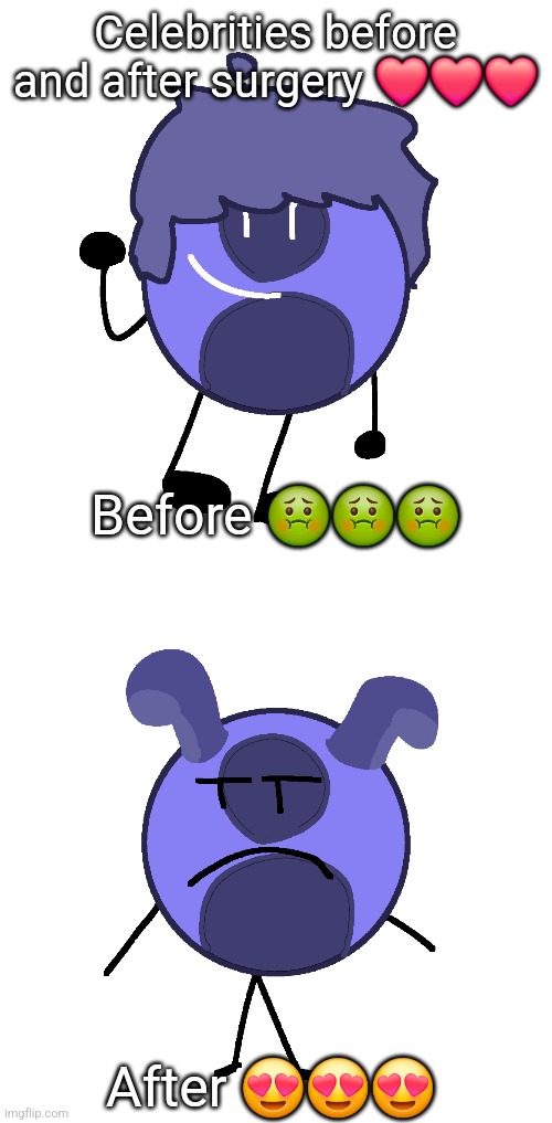Celebrities before and after surgery ❤️❤️❤️; Before 🤢🤢🤢; After 😍😍😍 | made w/ Imgflip meme maker