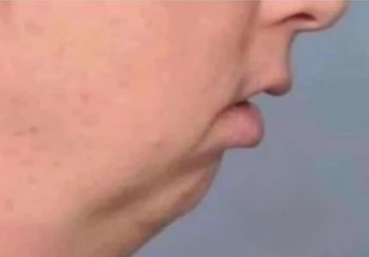 High Quality Fat face underbite side view Blank Meme Template