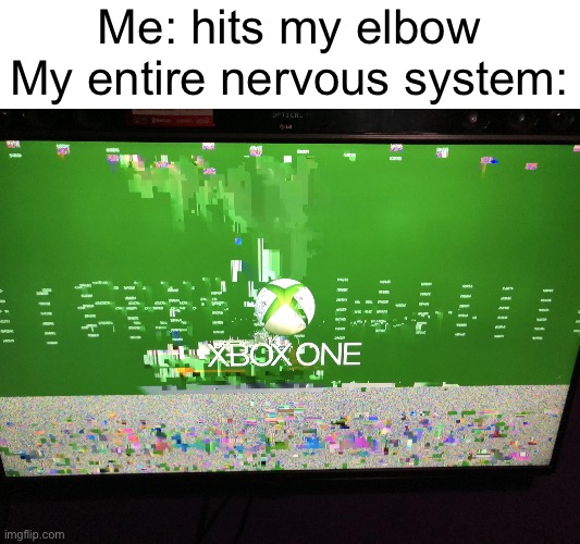 Every single time…. | Me: hits my elbow
My entire nervous system: | image tagged in xbox one crashed | made w/ Imgflip meme maker